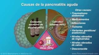 Pancreatitis aguda [upl. by Lucien]