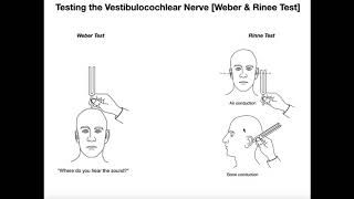 Interpreting the WeberRinne Tests EXPLAINED [upl. by Nogas932]