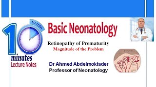 Retinopathy Of Prematurity [upl. by Tavi]