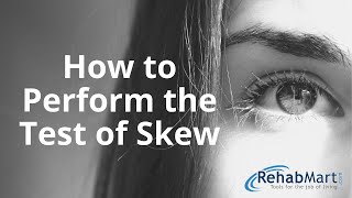 How to Perform the Test of Skew for Vertigo [upl. by Kristan]