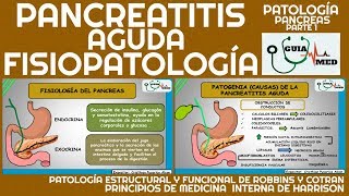 PANCREATITIS AGUDA FISIOPATOLOGÍA  GuiaMed [upl. by Pryor]