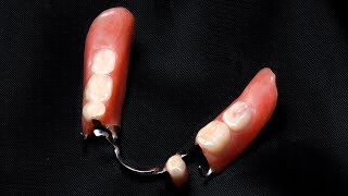 Cleaning Partial Dentures [upl. by Etra]