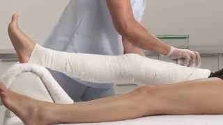 Plaster of Paris Knee Circular Cast Application [upl. by Patrich]