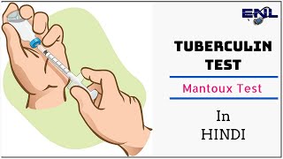 Mantoux Test  Tuberculin Skin Test in Hindi  Easy Explanation [upl. by Tedda]