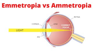 Emmetropia vs Ammetropia [upl. by Norag]