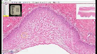 nonkeratinized stratified squamous epithelium [upl. by Eillek]