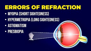 Errors of Refraction  Myopia  Hypermetropia  Astigmatism  Presbiopia  Short amp Long Sightedness [upl. by Nayb753]